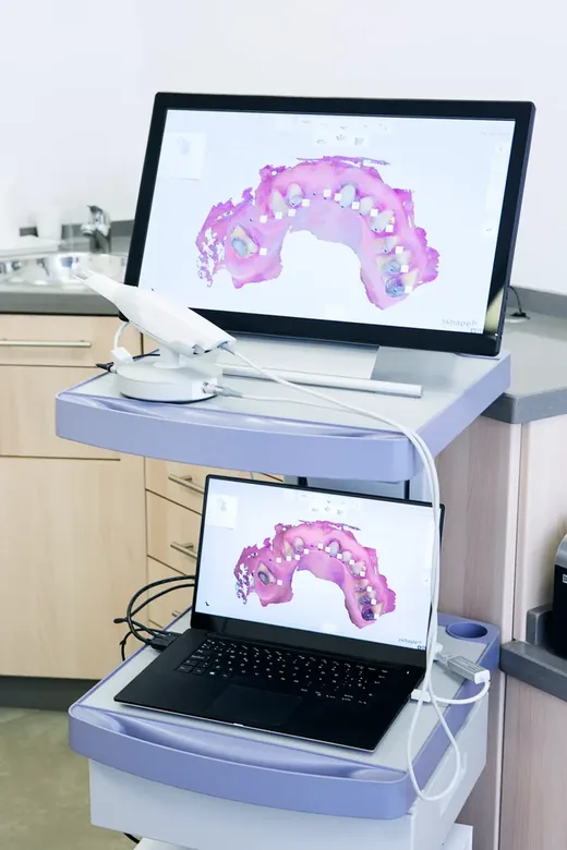 Intraoralscanner am Behandlungsplatz mit dem fertigen 3D-Scan des Kiefers auf Monitor und Laptop